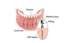 classic dental