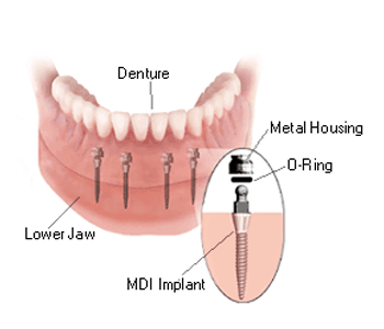 classic dental