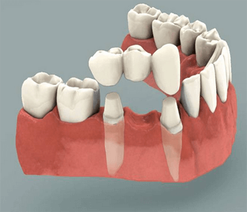classic dental